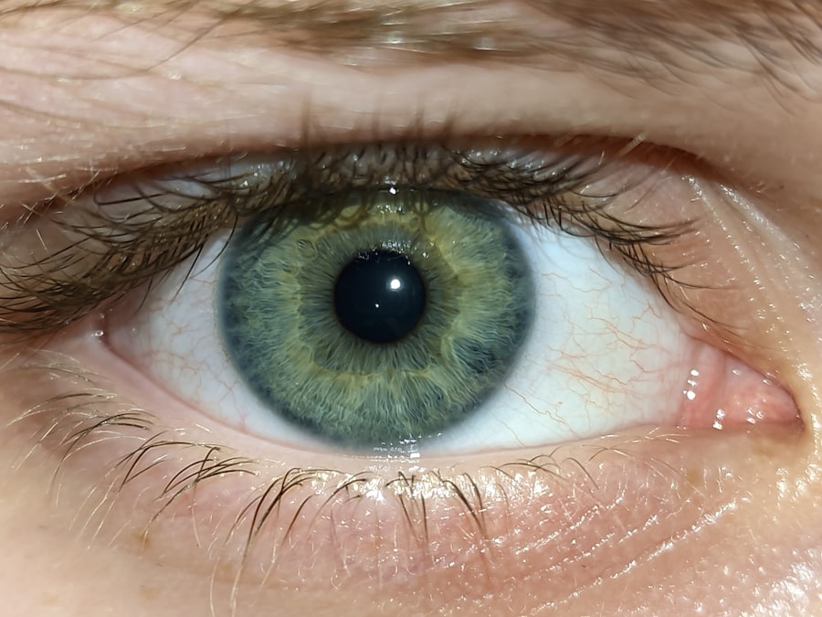 Eye Drops