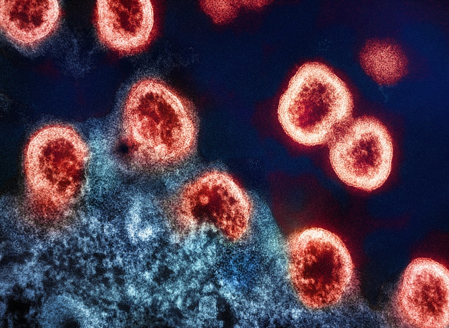 stress immune system