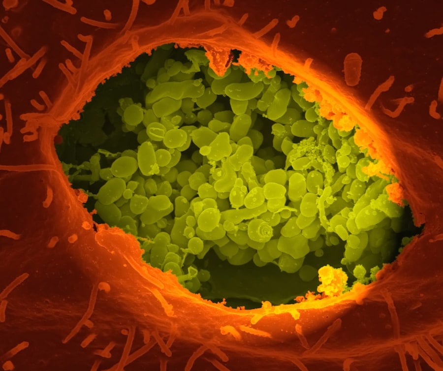 boost immune system