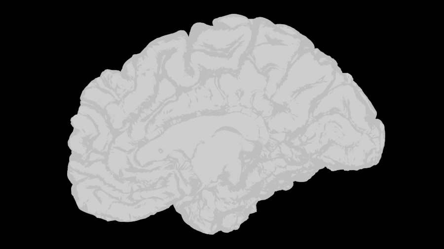 memory improvement techniques