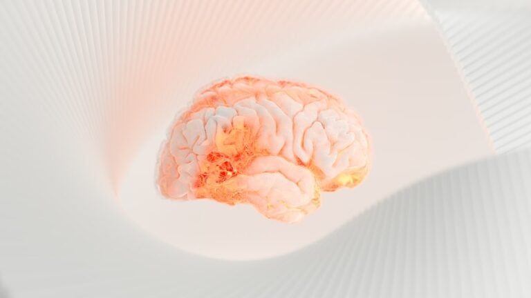 Photo brain health supplements