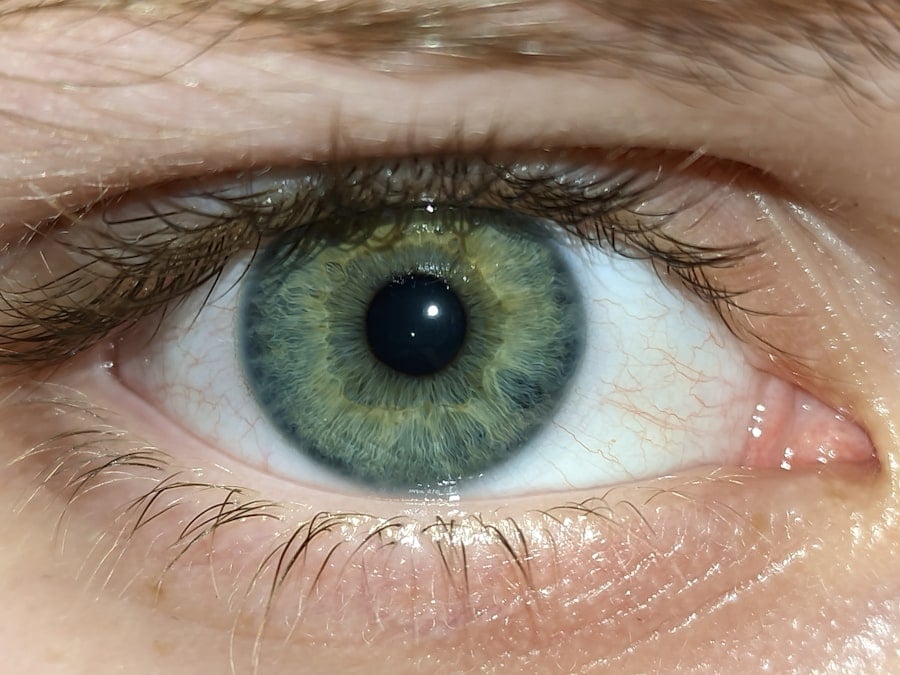 Photo Eye Vitamins